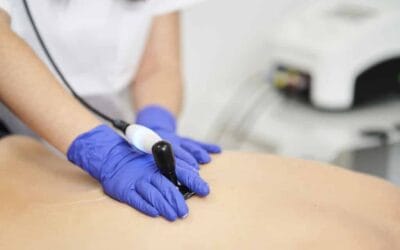 Diatermia: Innovación en la medicina estética en Huelva